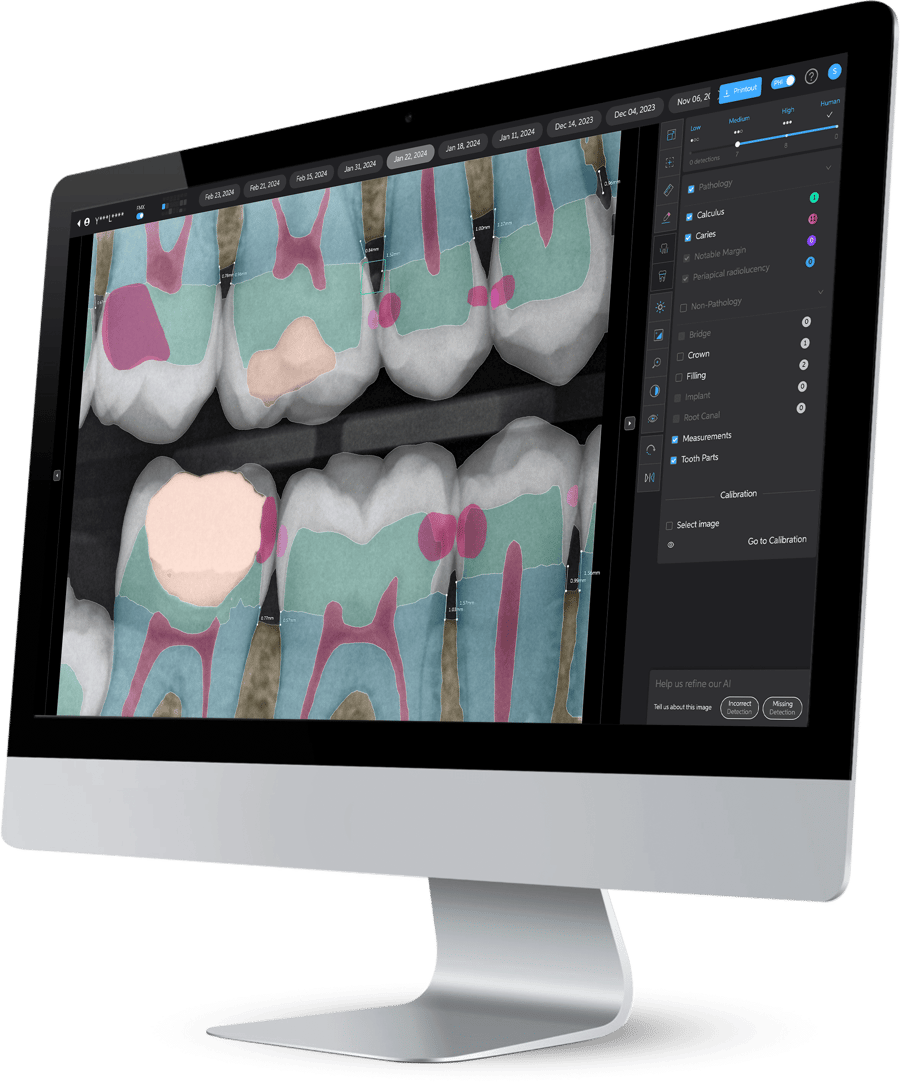 A computer monitor displaying Second Opinion by Pearl AI